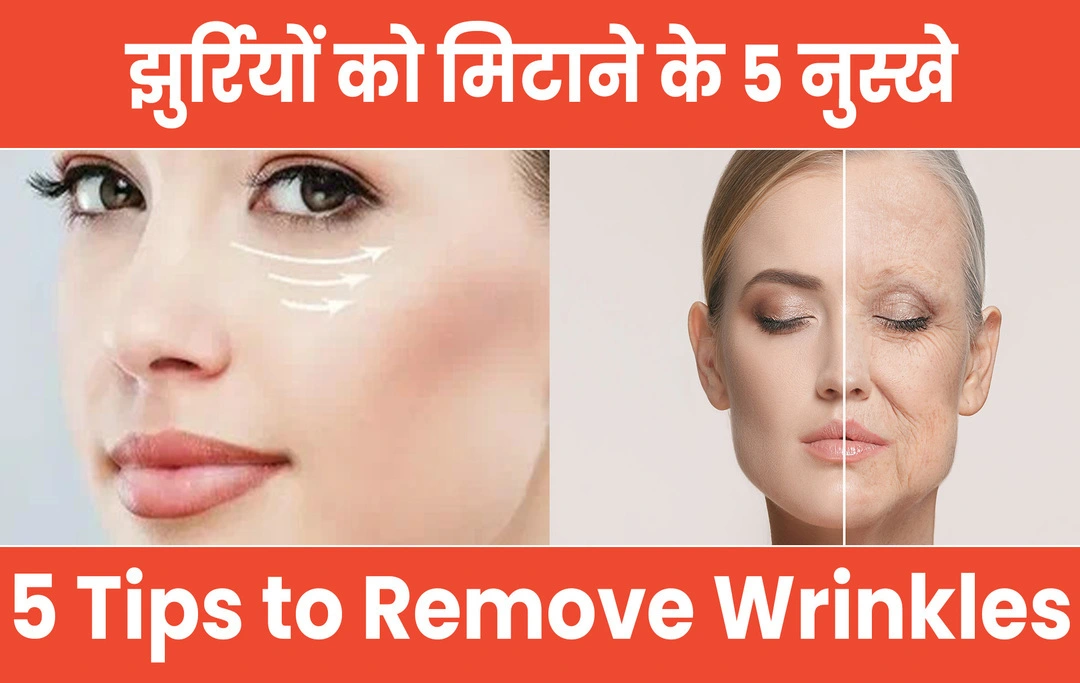 झुर्रियों को मिटाने के 5 नुस्खे | 5 tips to remove wrinkles